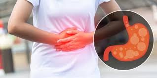 Rutin Minum Obat Maag, tapi lambung tetap bermasalah